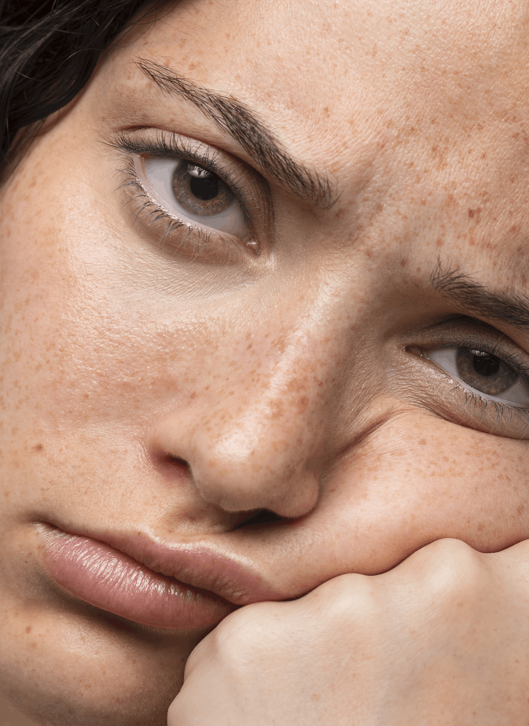 front-view-woman-expressing-sadness with dark spots