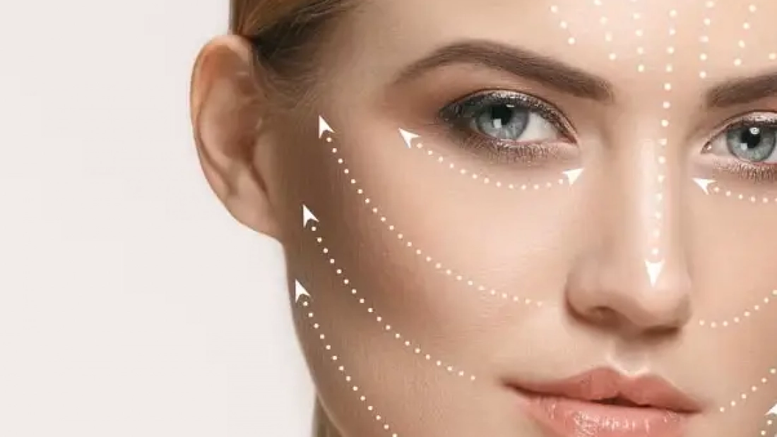 womans face showing skin booster mapping points