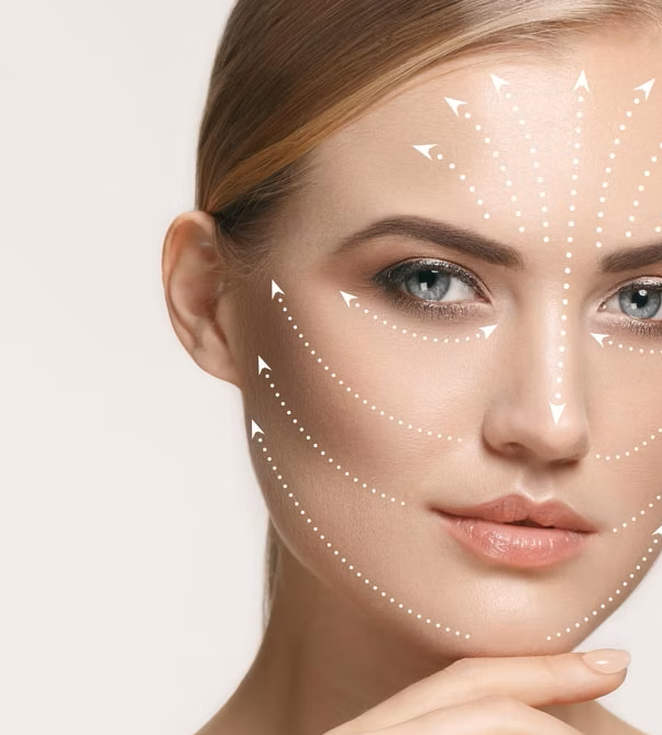 womans face showing skin booster mapping points
