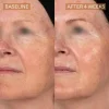 The Skin Diary Pro Helix C before and after image